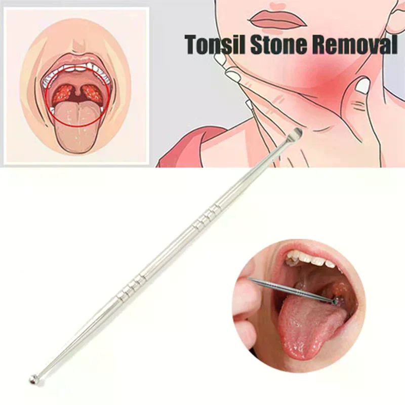Ear Wax Remover - 1pc Remover Tool Stainless Tonsil Stone