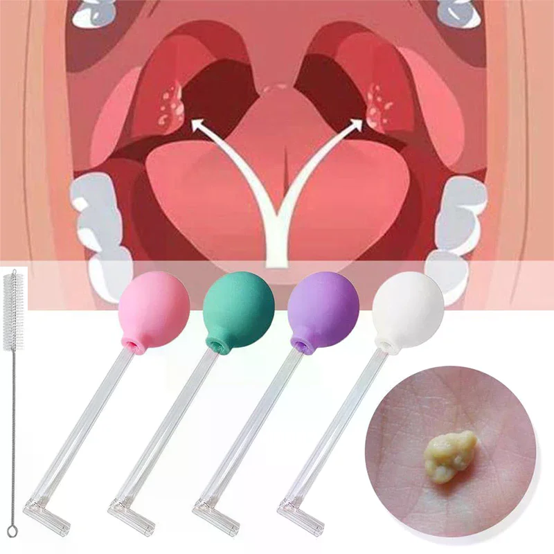 Stone Remover Tool Manual Styl - Ear Wax Remover ulasan dan harga