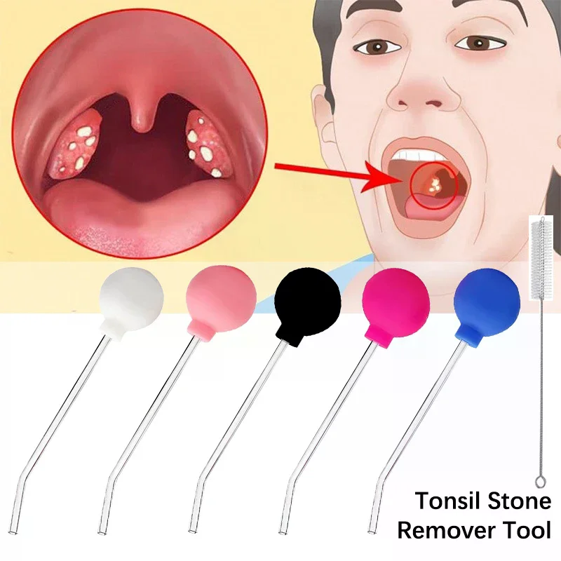 Stone Remover Tool Manual Styl - Ear Wax Remover ulasan dan harga